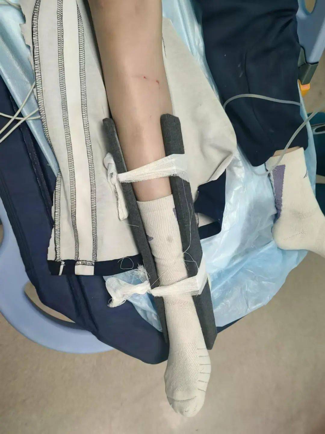 惨痛<strong></p>
<p>链圈</strong>!一人身亡!深圳多名学生骑电动车发生意外