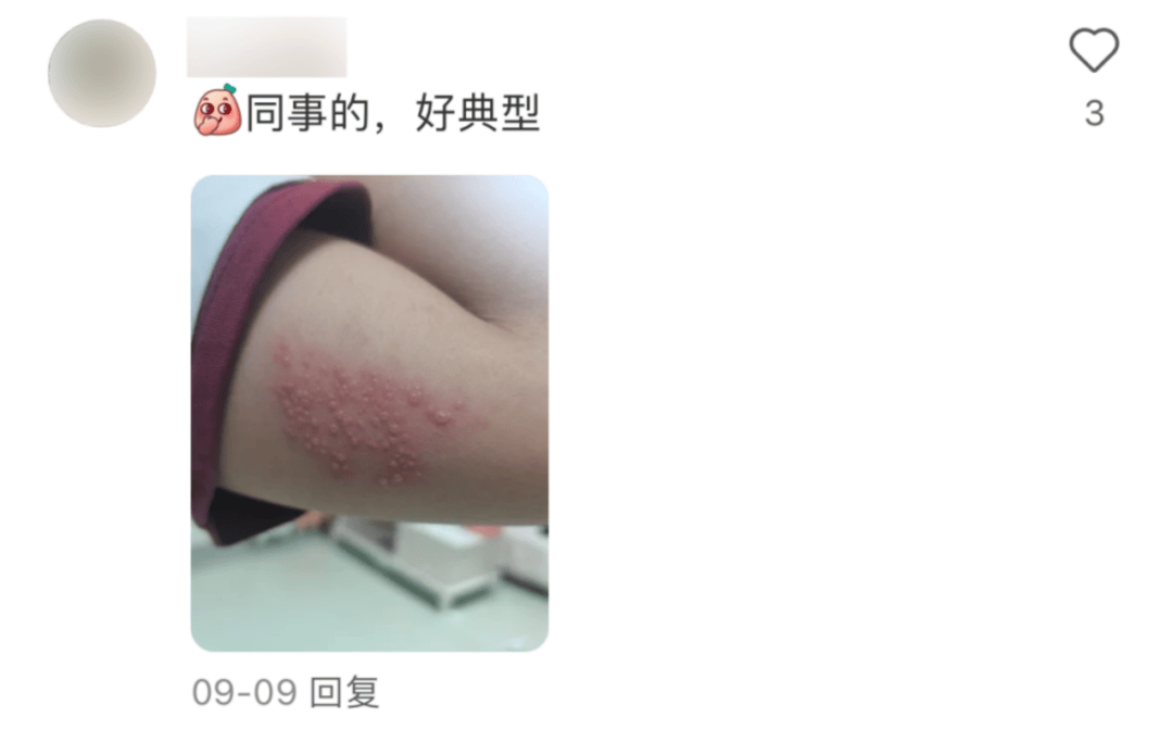 一旦感染终身携带<strong></p>
<p>打制币</strong>!深圳疾控提醒:这4类人要注意