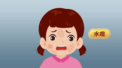 一旦感染终身携带<strong></p>
<p>打制币</strong>!深圳疾控提醒:这4类人要注意