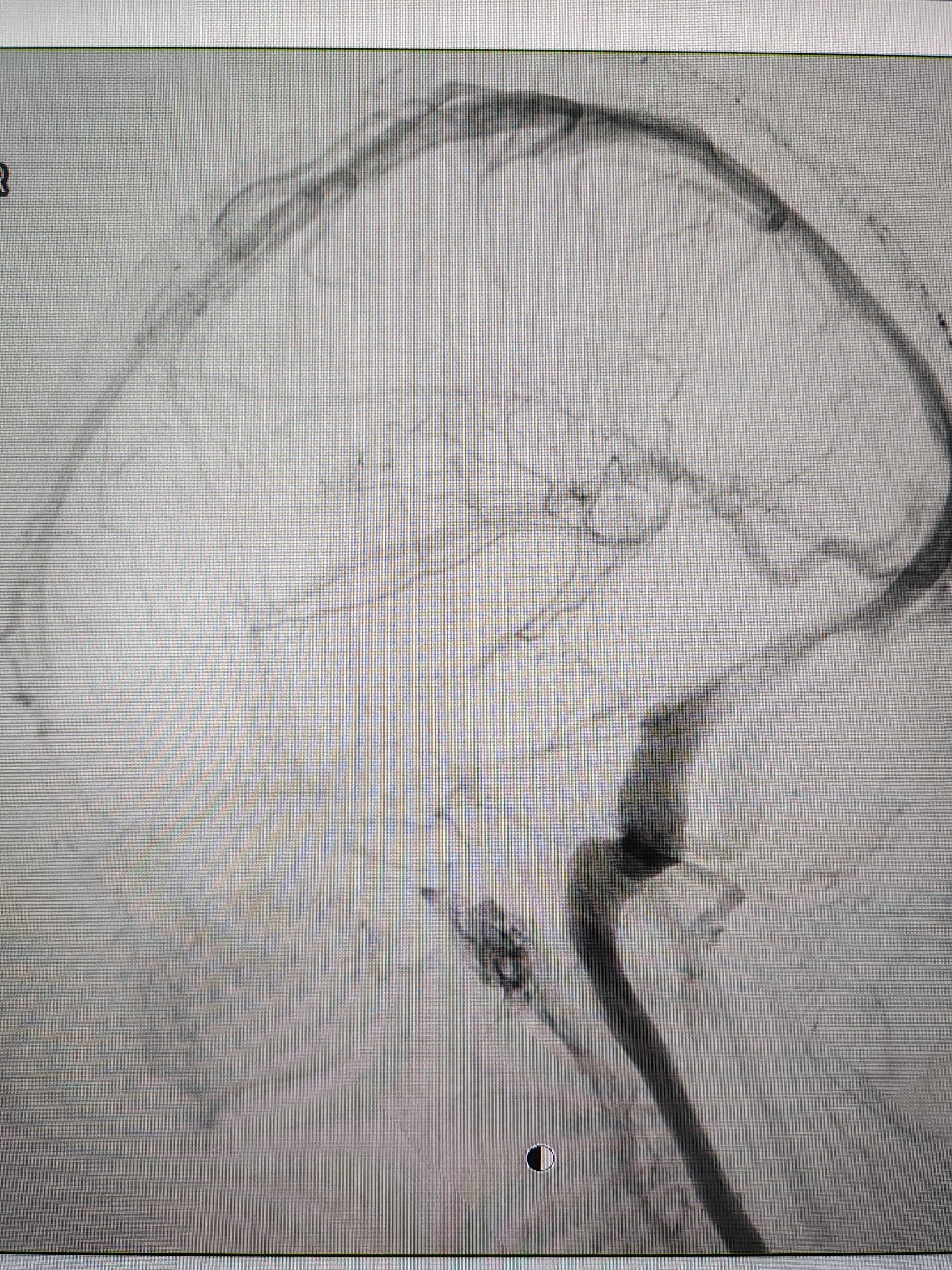 吉林女子患罕见耳鸣7年<strong></p>
<p>门罗币app</strong>，慕名千里来顺德寻医终获新生
