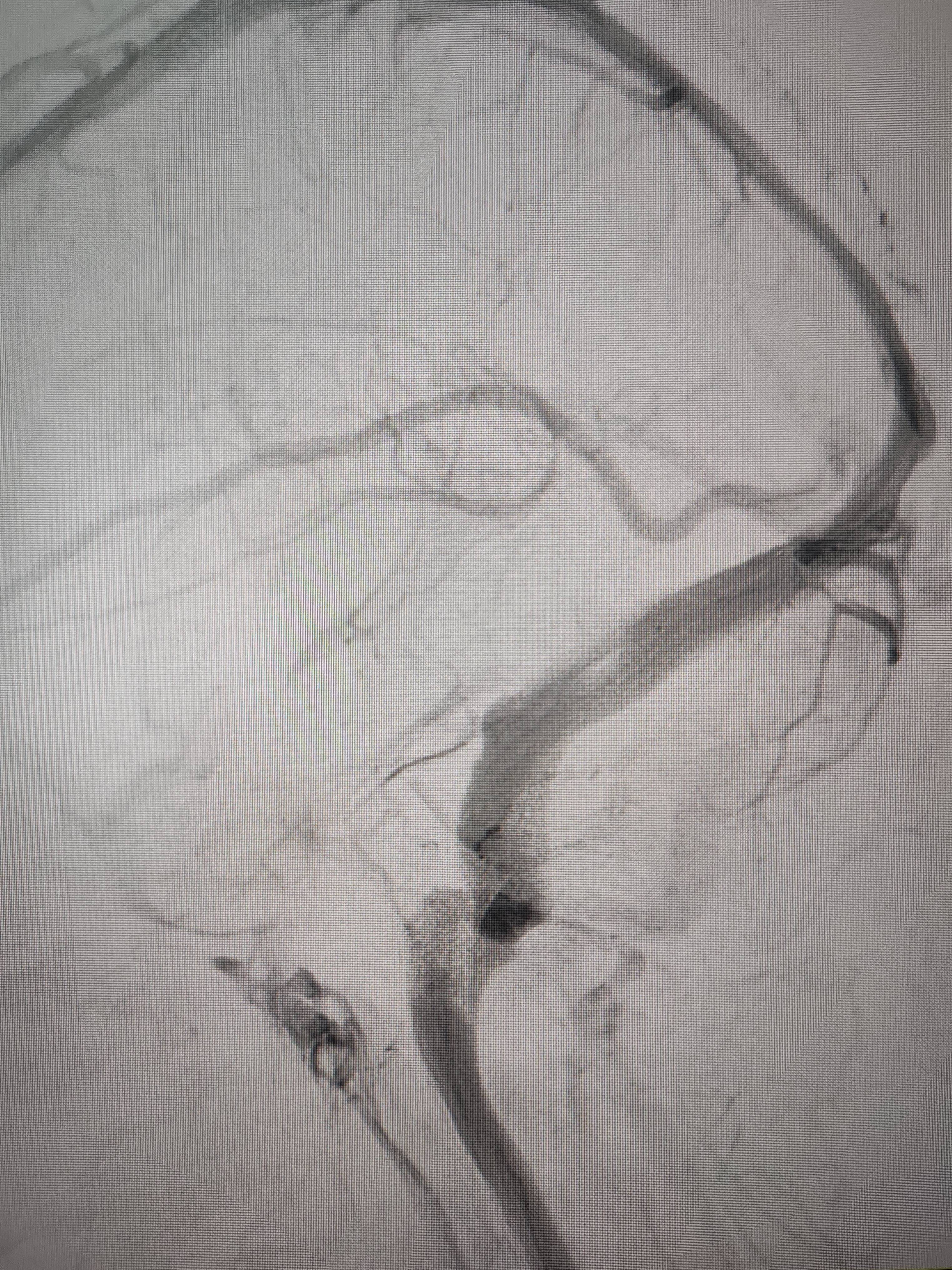 吉林女子患罕见耳鸣7年<strong></p>
<p>门罗币app</strong>，慕名千里来顺德寻医终获新生