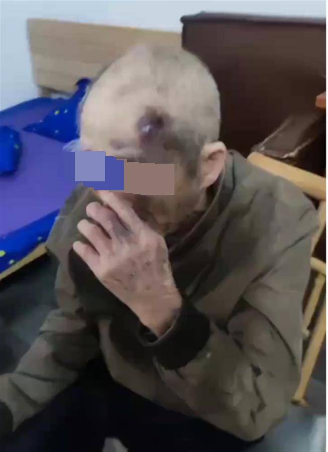 广东阳江一养老院护工长期虐待九旬老人?民政局已介入<strong></p>
<p>炒币盯盘</strong>,警方:正了解情况