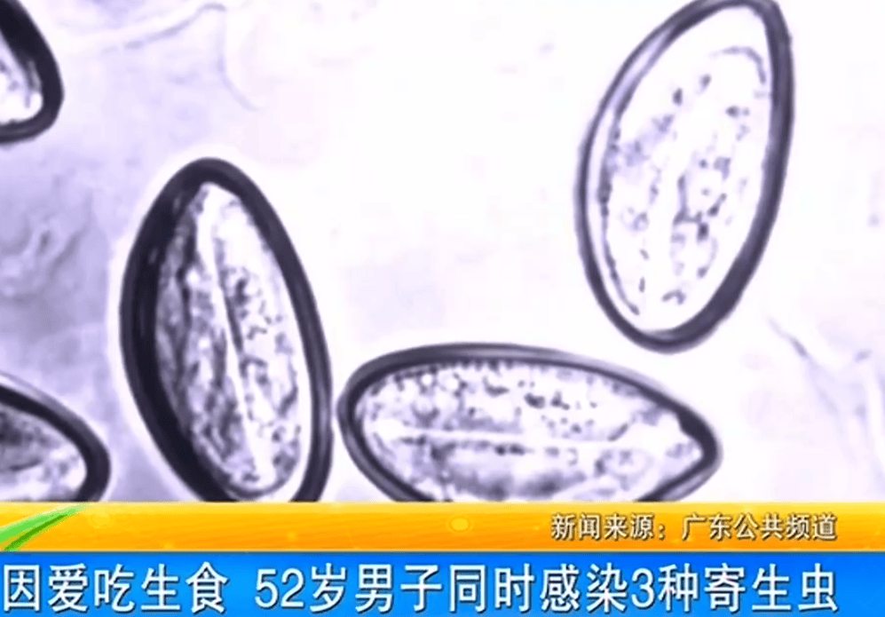 女子体内排出10米长绦虫<strong></p>
<p>职业炒币</strong>!原是两年前旅游时吃了这种食物