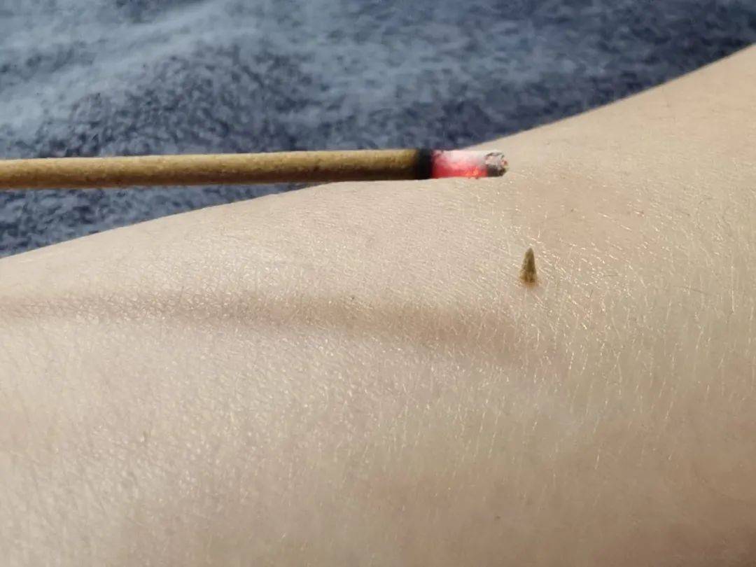 醒来“天塌了”<strong></p>
<p>飞猪</strong>！深圳一女子眼睛闭不上、嘴巴漏水！这些错误很多人会犯