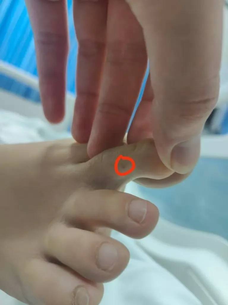 女子疑被蛇咬身亡事件进展:家属正在酒店收拾逝者遗物<strong></p>
<p>币圈入门</strong>,称暂无处置结果