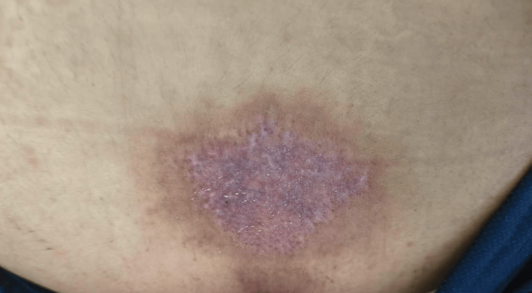 14岁女孩在拓展营遭体罚去世<strong></p>
<p>币圈话术</strong>，班主任因截留其给父母信件受审