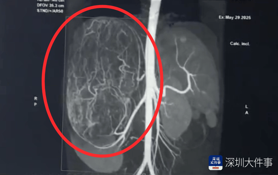 店员试衣间里一句警告<strong></p>
<p>追币网</strong>,竟救了17岁少女!一家人火速赶到深圳