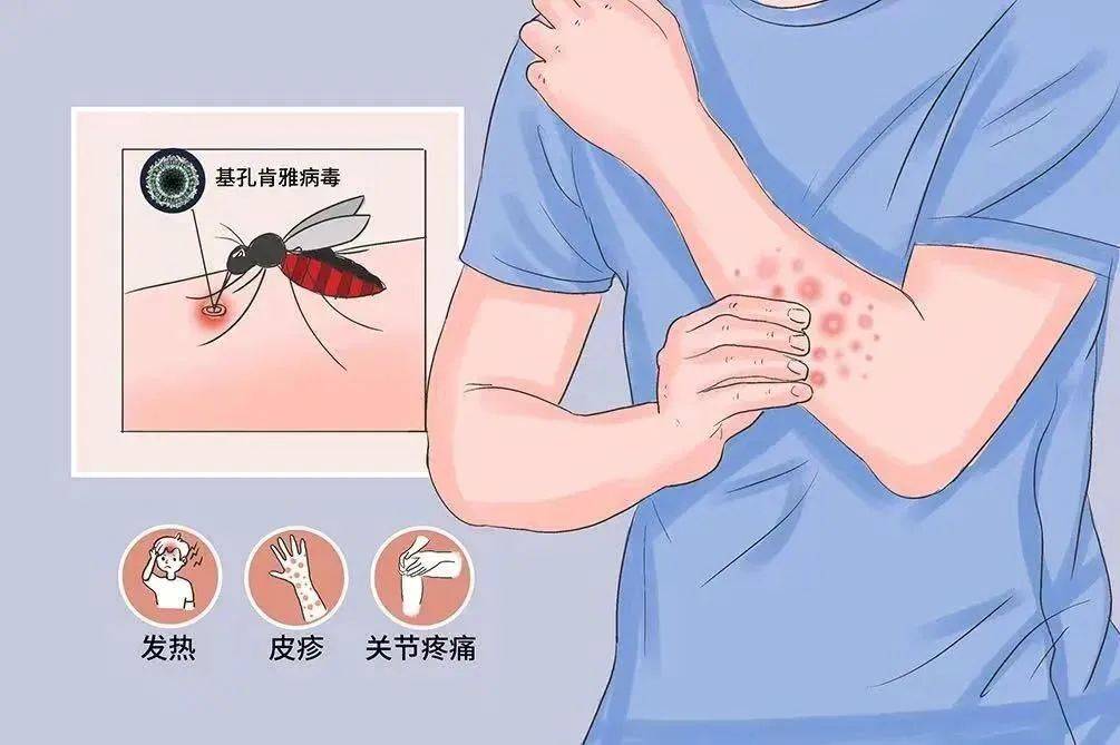 风险增大<strong></p>
<p>爱币投</strong>！深圳疾控：去这247处要小心！张文宏首次发声