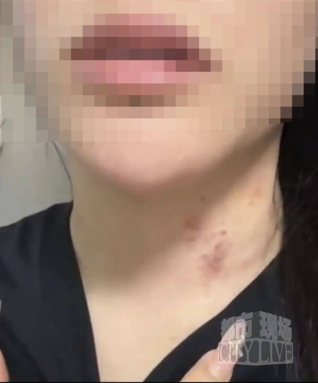 湖南衡阳29岁女子疑被男友施暴后从25楼跳下身亡 男友徐某此前还刺激说:“你放心<strong></p>
<p>币改</strong>,她不会去死的”