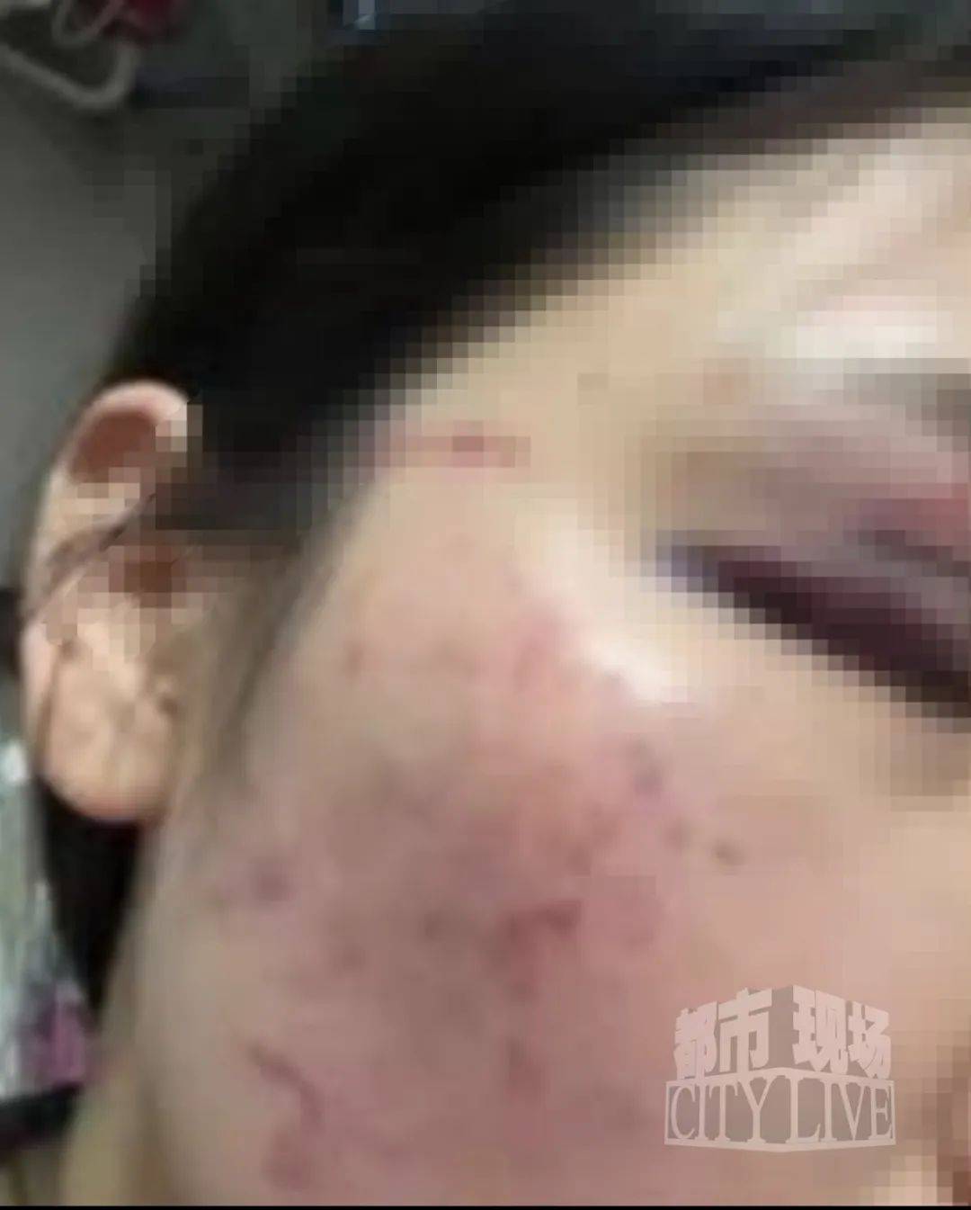 湖南衡阳29岁女子疑被男友施暴后从25楼跳下身亡 男友徐某此前还刺激说:“你放心<strong></p>
<p>币改</strong>,她不会去死的”