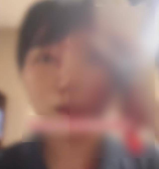 缝了20多针!女子称被不知名男同事砸头毁容<strong></p>
<p>币多多交易</strong>,警方介入