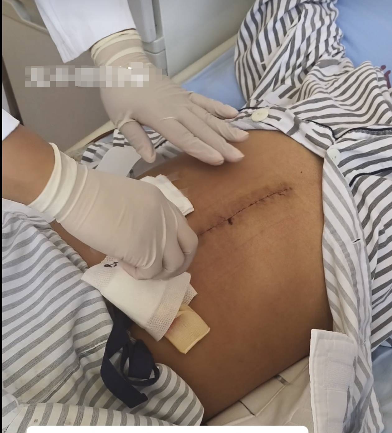 奶奶在哭<strong></p>
<p>智能炒币软件</strong>,宝宝在笑!40天女婴重病,00后父亲割肝救女,术后这一幕让网友泪奔