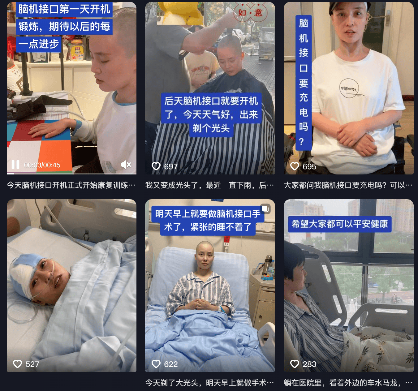 女子因车祸全身瘫痪6年仅嘴眼能动<strong></p>
<p>炒币亏</strong>,接受脑机接口手术后通过意念抓取物品!当事人讲述