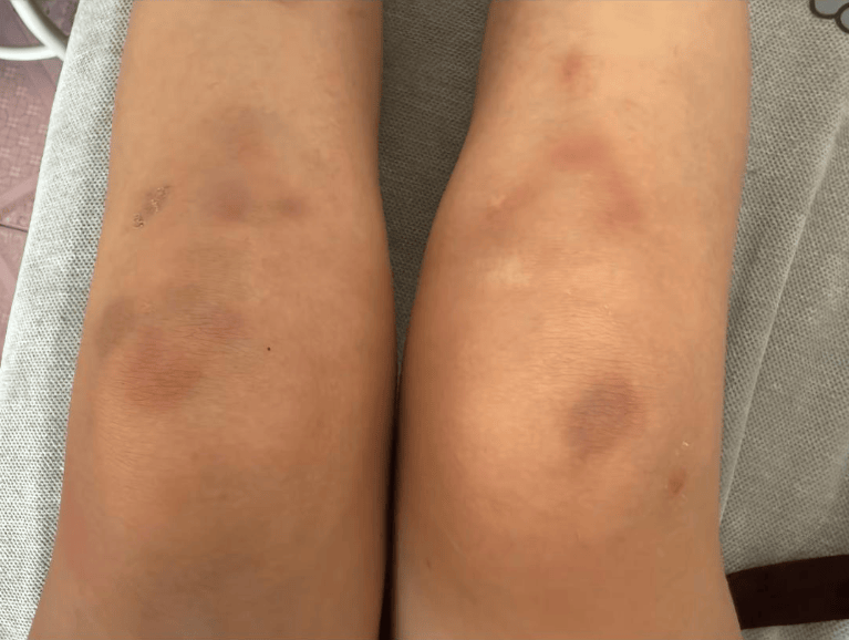 女子自称因工资问题被老板锁办公室里打 警方:双方已到派出所<strong></p>
<p>cbb炒币吧</strong>,是否打人还在调查