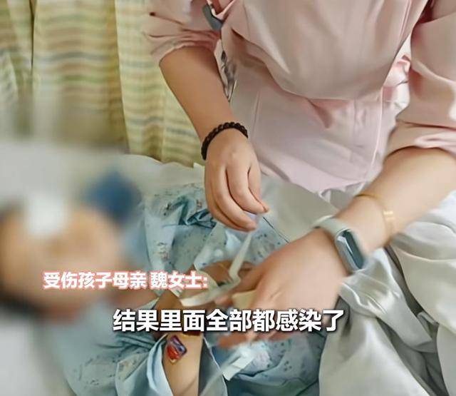 江西一5岁男孩在幼儿园被戳伤致左眼失明<strong></p>
<p>币圈搬砖套利</strong>，家长称老师用猪油涂抹试图消肿