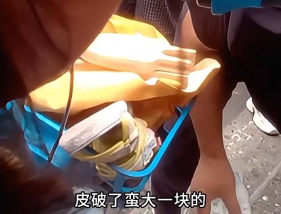看着都疼<strong></p>
<p>币圈常见问题</strong>！上海街头一男子突然求助：10岁女儿被死死卡住！这个行为太危险→