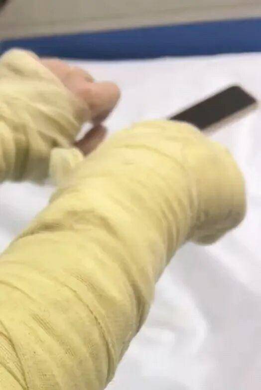 湖南一女主播被伪装的包裹炸伤<strong></p>
<p>币圈常见问题</strong>，永州公安：正在核实具体情况