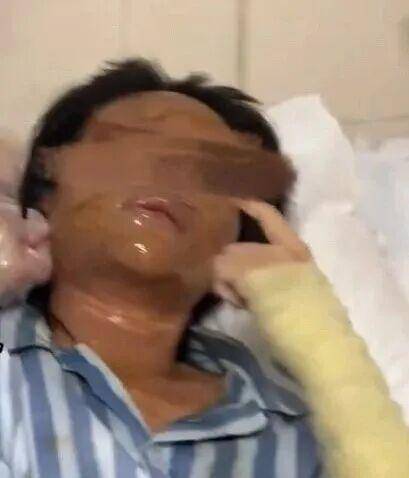 湖南一女主播被伪装的包裹炸伤<strong></p>
<p>币圈常见问题</strong>，永州公安：正在核实具体情况