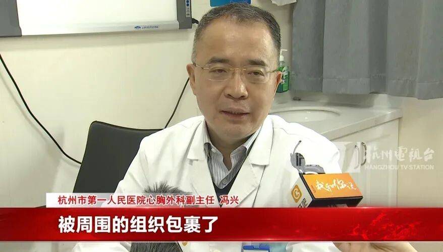 17岁小伙参军体检发现胸腔内有根5cm缝衣针<strong></p>
<p>币圈社区介绍</strong>，父母回忆或是1岁时扎入，取出时已锈迹斑斑